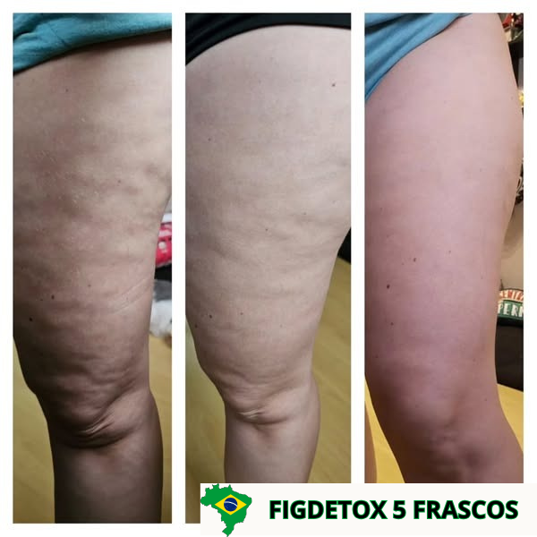 FIGDETOX-5-FRASCOS.png